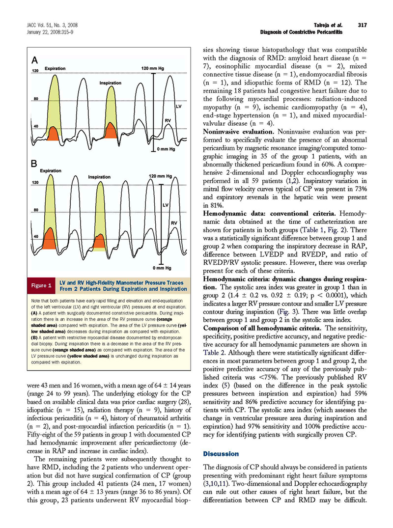 Pericardial Constriction